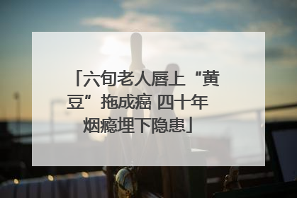 六旬老人唇上“黄豆”拖成癌 四十年烟瘾埋下隐患